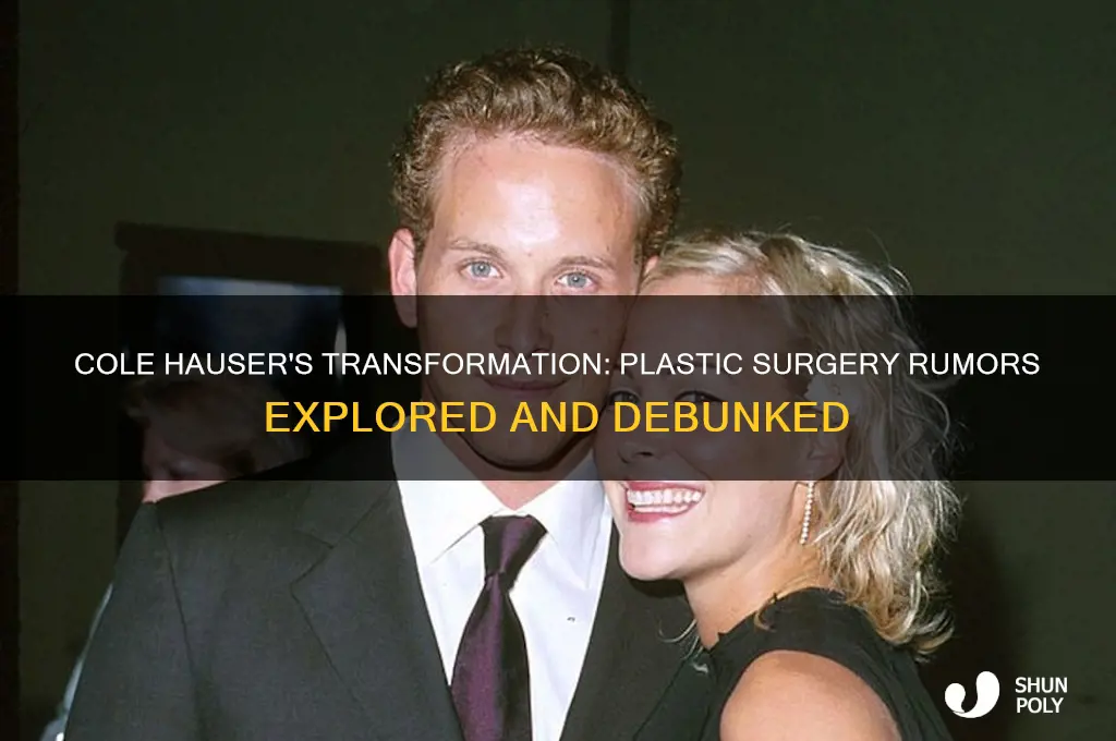 did cole hauser have plastic surgery
