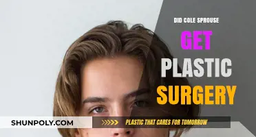 Cole Sprouse Plastic Surgery Rumors: Fact or Fiction?