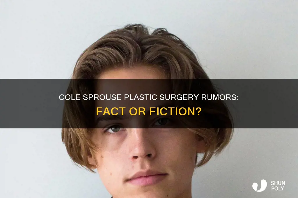 did cole sprouse get plastic surgery