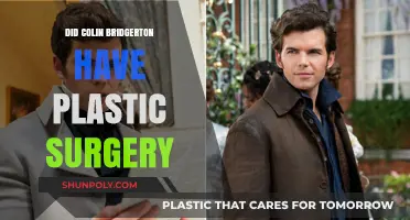 Colin Bridgerton's Transformation: Plastic Surgery Rumors Explored