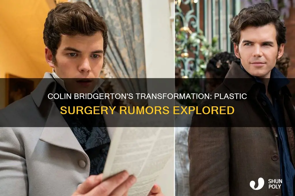 did colin bridgerton have plastic surgery
