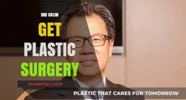 Colin's Transformation: Plastic Surgery Speculations and the Truth Revealed