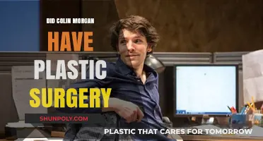 Colin Morgan Plastic Surgery: Fact-Checking the Rumors and Speculations