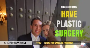 Colleen Lopez Plastic Surgery: Fact-Checking the Rumors and Speculations