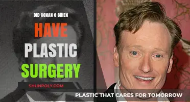 Conan O'Brien's Transformation: Plastic Surgery Rumors Explored