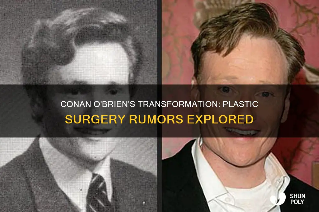 did conan o brien have plastic surgery