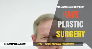 Did Congressman Mike Kelly Undergo Plastic Surgery? Unveiling the Truth