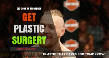 Did Conor McGregor Undergo Plastic Surgery? Unveiling the Truth