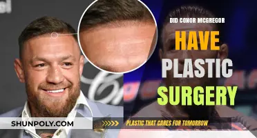 Conor McGregor's Transformation: Plastic Surgery Rumors Explored