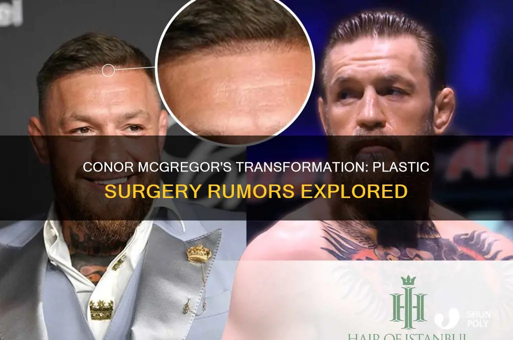 did conor mcgregor have plastic surgery
