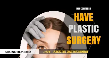 Did Contessa Undergo Plastic Surgery? Uncovering the Truth and Speculations