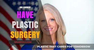 Did Conway Undergo Plastic Surgery? Uncovering the Truth Behind the Rumors