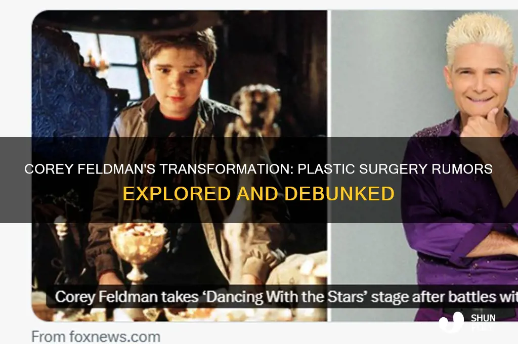 did corey feldman get plastic surgery