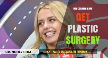 Corinna Kopf Plastic Surgery: Fact-Checking the Rumors and Speculations