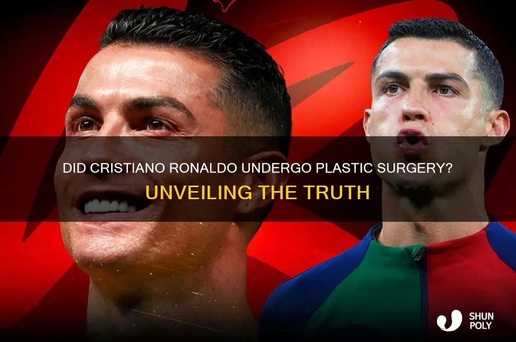 did cr7 get plastic surgery
