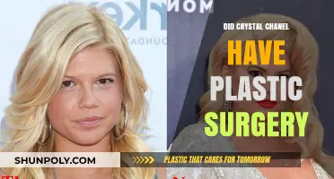 Crystal Chanel's Transformation: Plastic Surgery Rumors and Realities