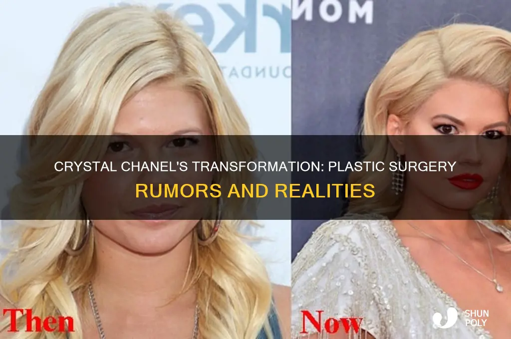 did crystal chanel have plastic surgery