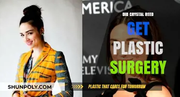 Crystal Reed Plastic Surgery: Fact-Checking the Transformation Rumors