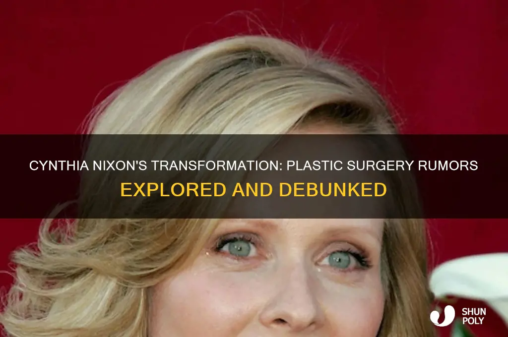 did cynthia nixon have plastic surgery