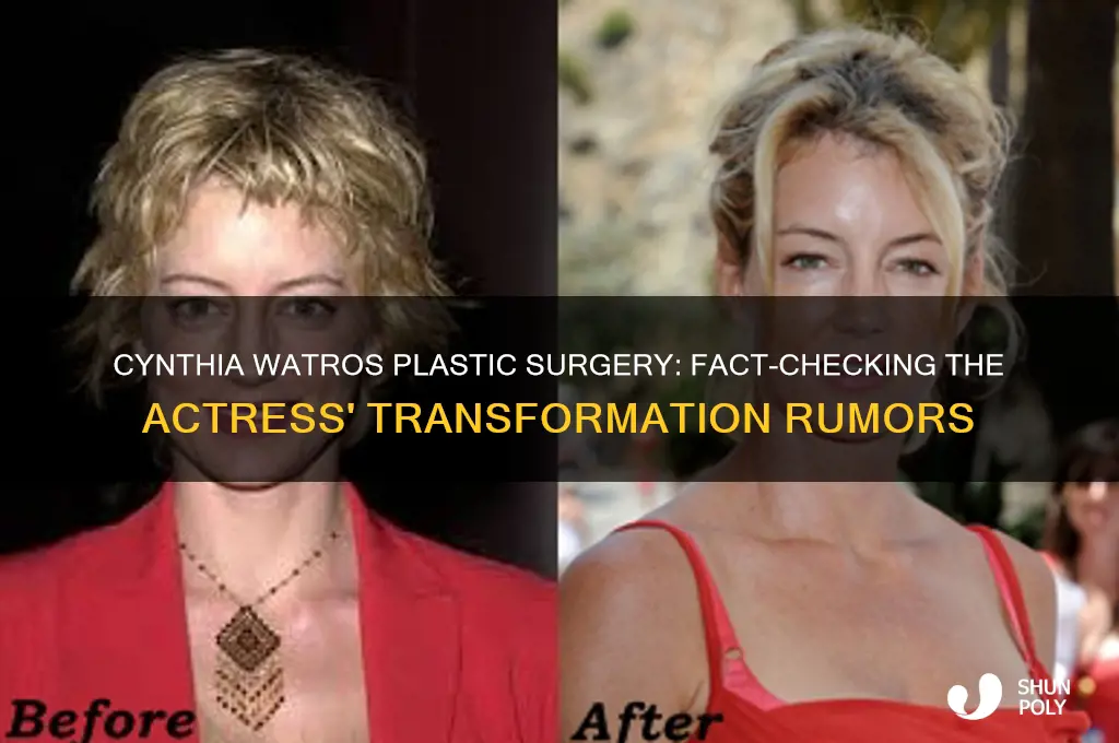 did cynthia watros have plastic surgery