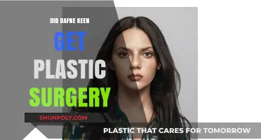 Dafne Keen Plastic Surgery: Fact-Checking the Rumors and Speculations