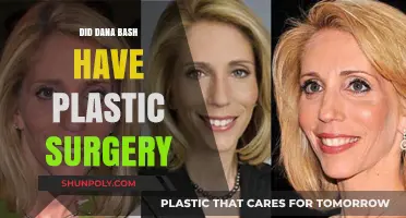 Dana Bash Plastic Surgery: Fact-Checking the Rumors and Speculations