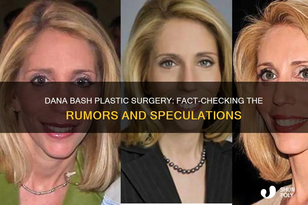 did dana bash have plastic surgery