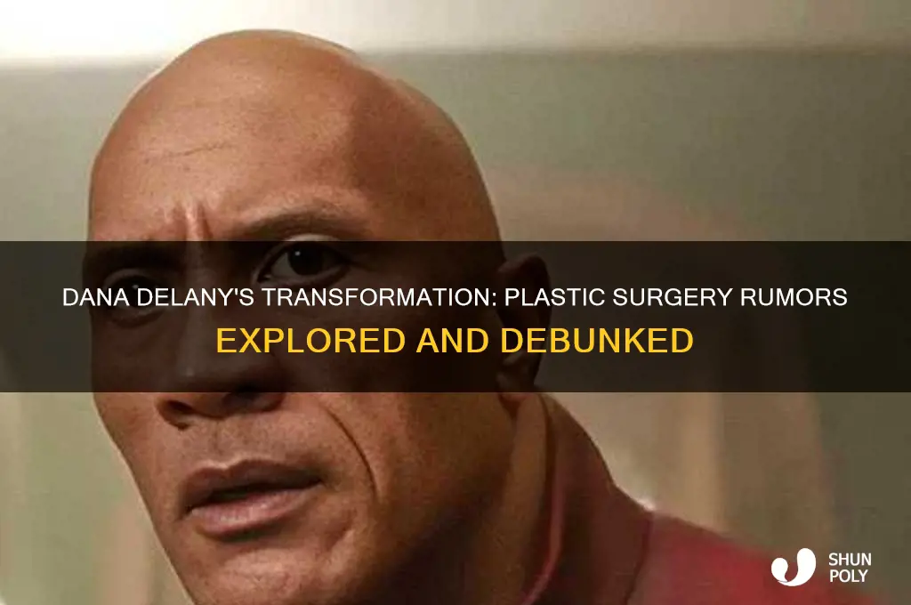 did dana delany have plastic surgery