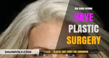 Dana Perino Plastic Surgery: Fact-Checking the Rumors and Speculations