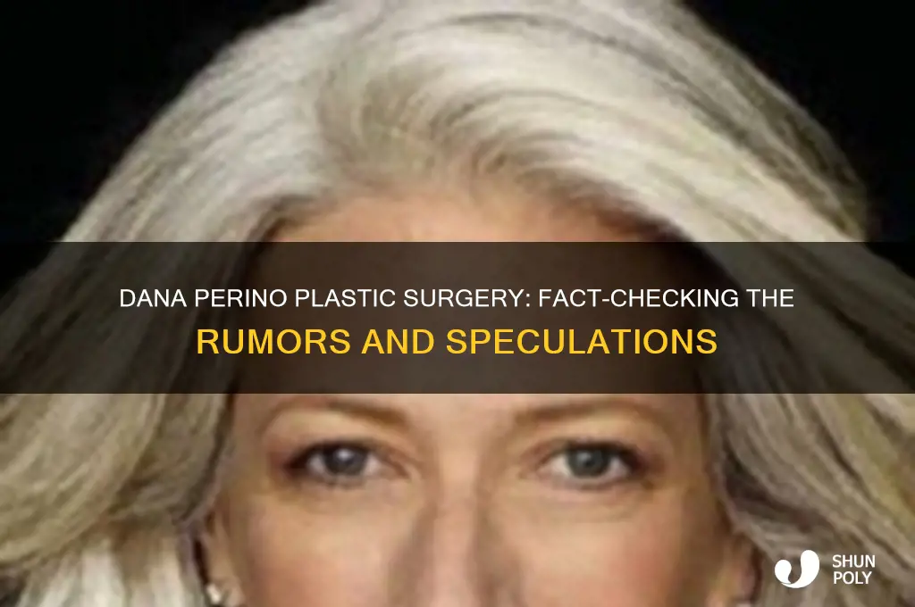 did dana perino have plastic surgery
