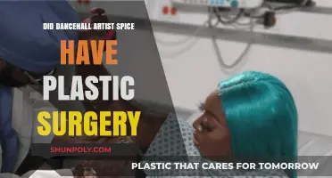 Spice's Transformation: Plastic Surgery Rumors in Dancehall Spotlight