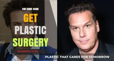 Dane Cook's Transformation: Plastic Surgery Rumors Explored and Debunked