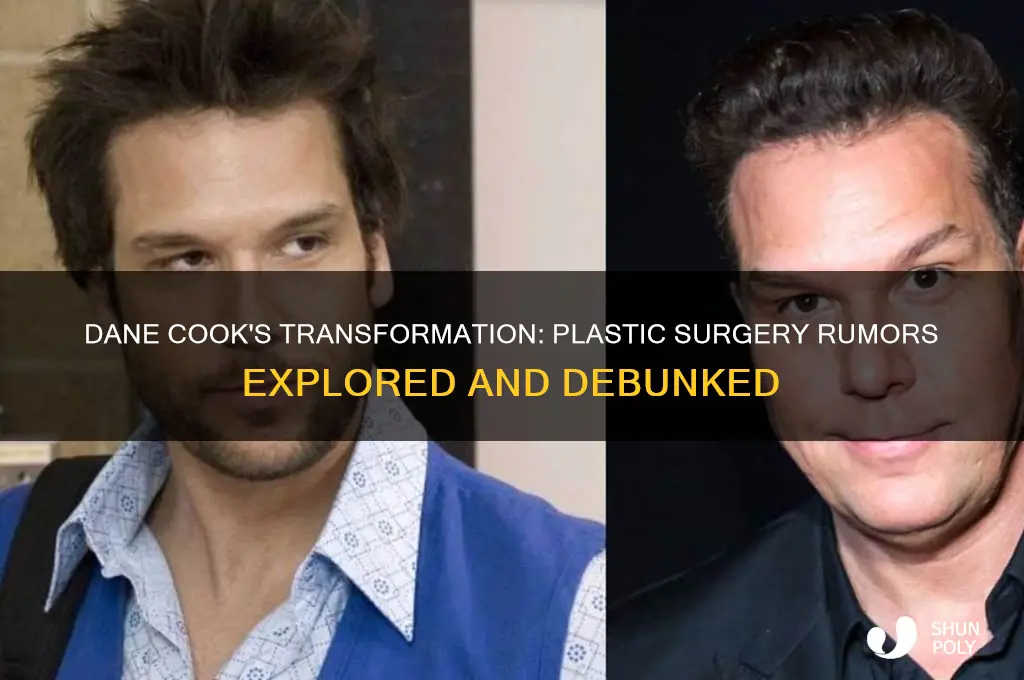 did dane cook get plastic surgery