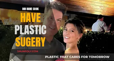 Plastic Surgery Speculations: Dane Cook's Transformation
