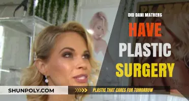 Dani Mathers Plastic Surgery: Fact-Checking the Rumors and Speculations