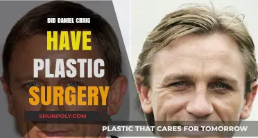 Daniel Craig's Transformation: Plastic Surgery Rumors Explored and Debunked