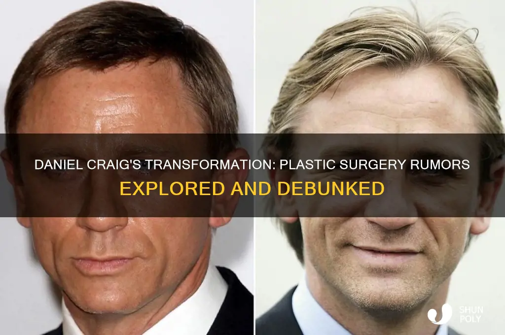 did daniel craig have plastic surgery