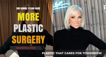 Daniel Staub's Plastic Surgery: Unveiling the Truth Behind the Rumors