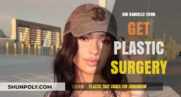 Did Danielle Cohn Undergo Plastic Surgery? Unraveling the Truth
