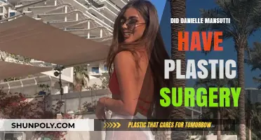 Did Danielle Mansutti Undergo Plastic Surgery? Unveiling the Truth