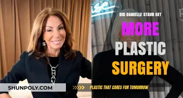 Danielle Staub's Latest Transformation: More Plastic Surgery Rumors Explored