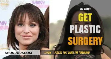 Did Darcy Undergo Plastic Surgery? Unraveling the Truth and Speculations