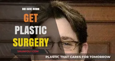 Did Dave Rubin Undergo Plastic Surgery? Examining the Rumors and Evidence