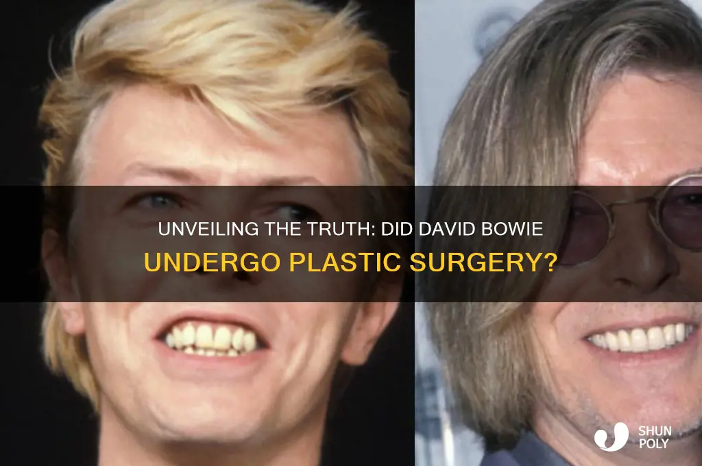 did david bowie have plastic surgery