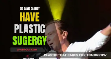 Plastic Surgery: David Cassidy's Transformation