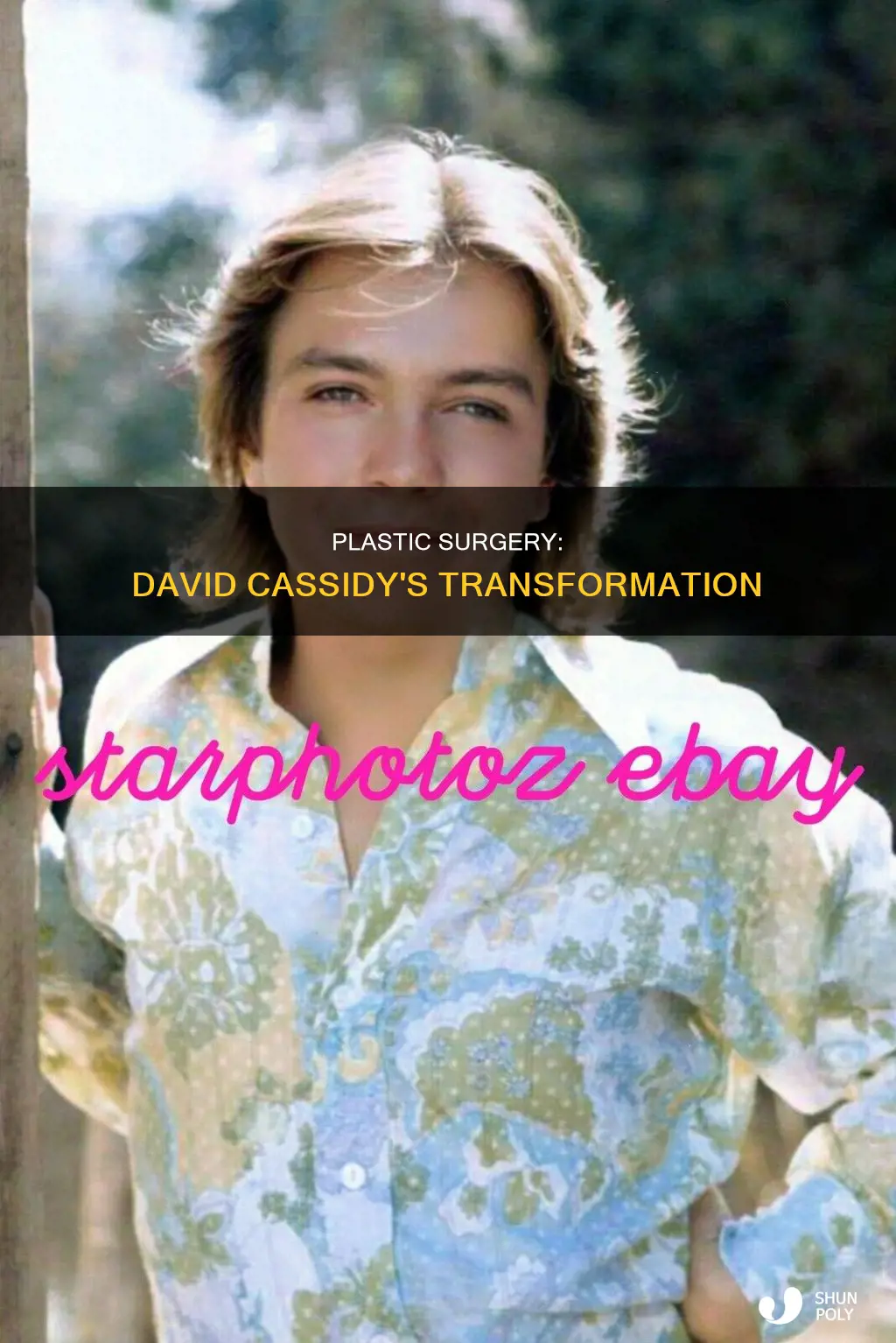 did david cassidy have plastic sugergy