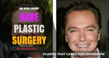 David Cassidy's Transformation: Uncovering the Truth About Plastic Surgery