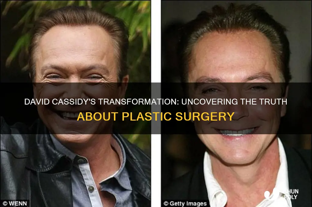 did david cassidy have plastic surgery