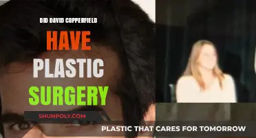 David Copperfield's Transformation: Plastic Surgery Speculations and Facts