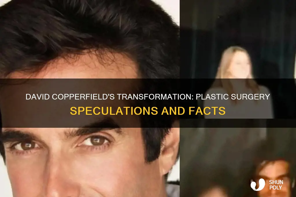 did david copperfield have plastic surgery